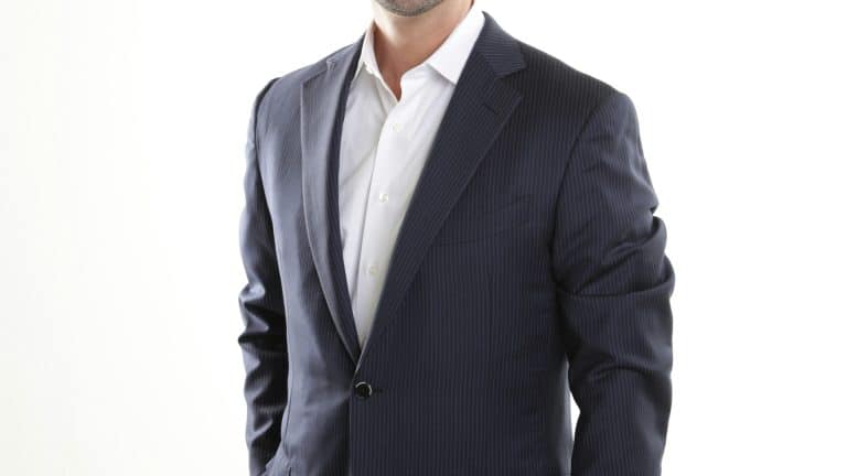 Comprendre la calvitie et les solutions de greffe de cheveux pour l'homme